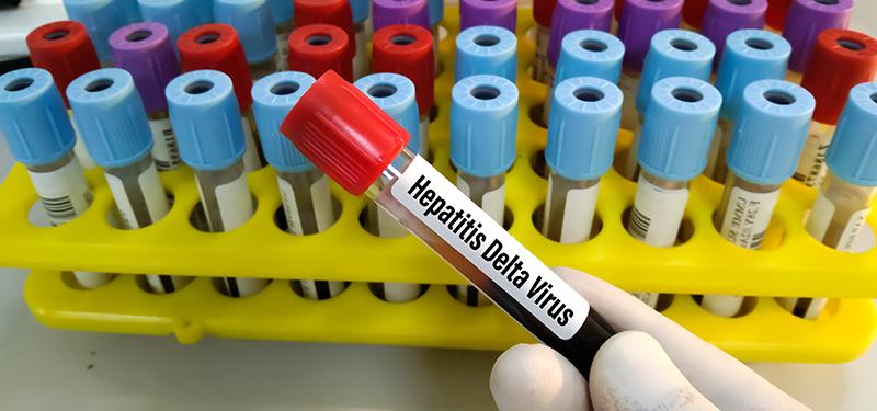 Long-term bulevirtide use safe, efficacious in patients with chronic HDV