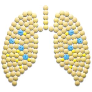 PPIs raise death risk in advanced NSCLC patients on antitumour therapy