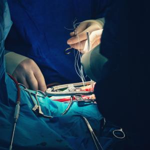 AKI after percutaneous edge-to-edge mitral repair tied to worse outcomes