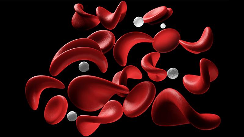 Long-term voxelotor use increases Hb, reduces haemolysis markers in patients with SCD