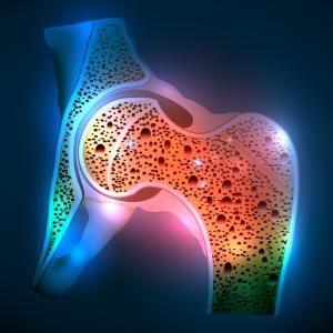 Denosumab shows promise in bisphosphonate-refractory fibrous dysplasia