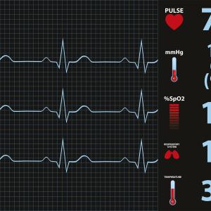 Ambulatory heart rate parameters predict death in hypertensive patients