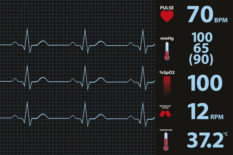 Ambulatory heart rate parameters predict death in hypertensive patients