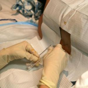 Lumbar puncture rate drops in infants with suspected serious bacterial infection