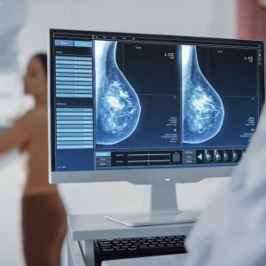 Can very low-risk breast cancer patients be spared from postop radiotherapy?