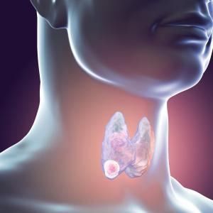 Thyroid diseases uncommon among patients with HIV