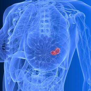 Regional anaesthesia-analgesia offers little in terms of breast cancer recurrence risk