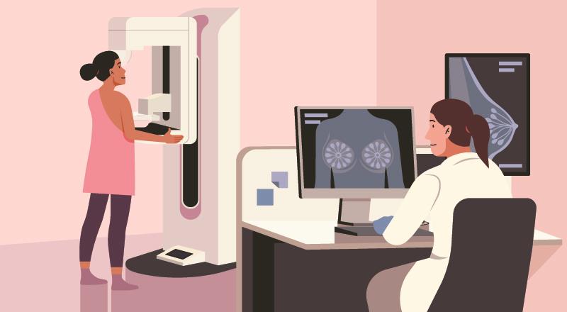 Mammo-50: Reduced mammogram frequency postsurgery may suffice for older women