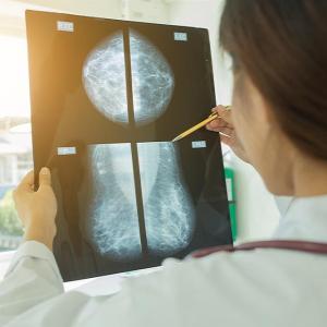 Artificial intelligence gets an A for detecting breast cancer