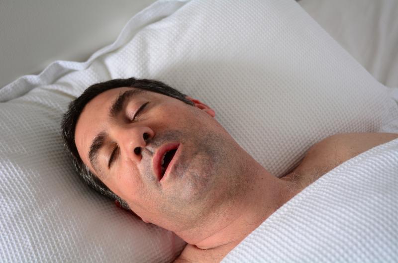 BMI drives causal relationship of sleep apnoea, snoring with T2D