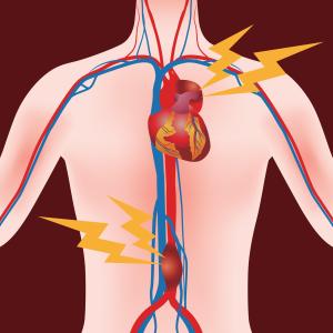 Dietary vitamins C and E may protect against aortic aneurysm, dissection