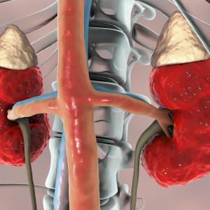 Myeloperoxidase level predicts disease progression in CKD