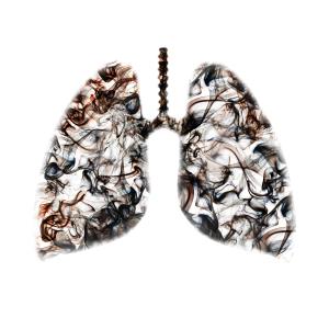 Eosinophil count <2 percent predicts longer hospital stay in COPD exacerbations