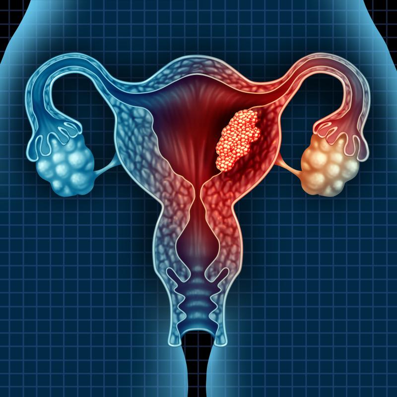 Pembrolizumab looks good for treated, advanced MSI-H/dMMR endometrial cancer