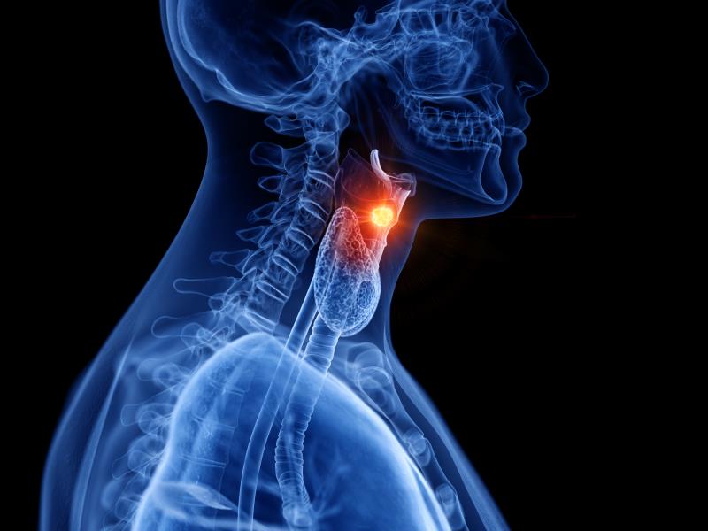 Imaging may help predict efficacy of immune checkpoint inhibitors in head and neck cancer