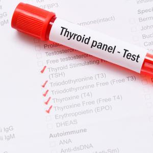 Exogenous hyper-, hypothyroidism up risk of stroke