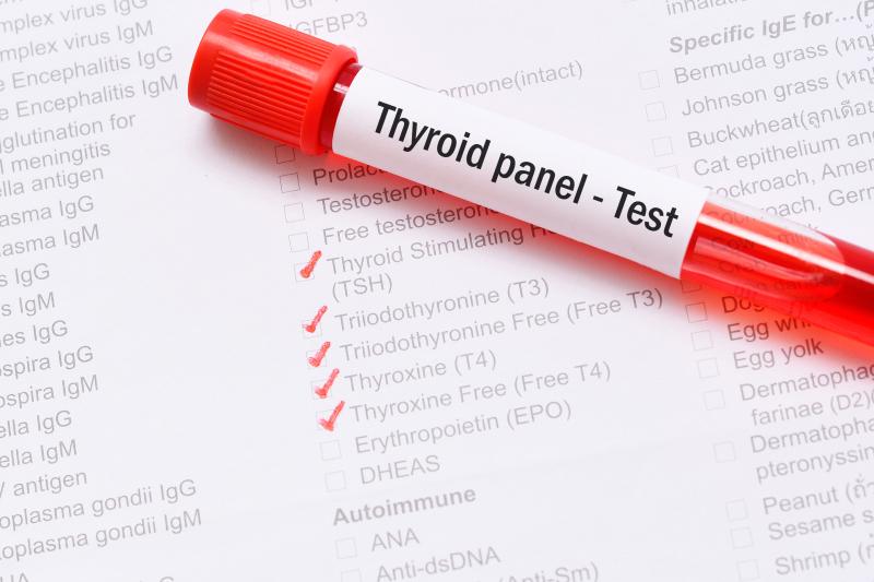 Exogenous hyper-, hypothyroidism up risk of stroke