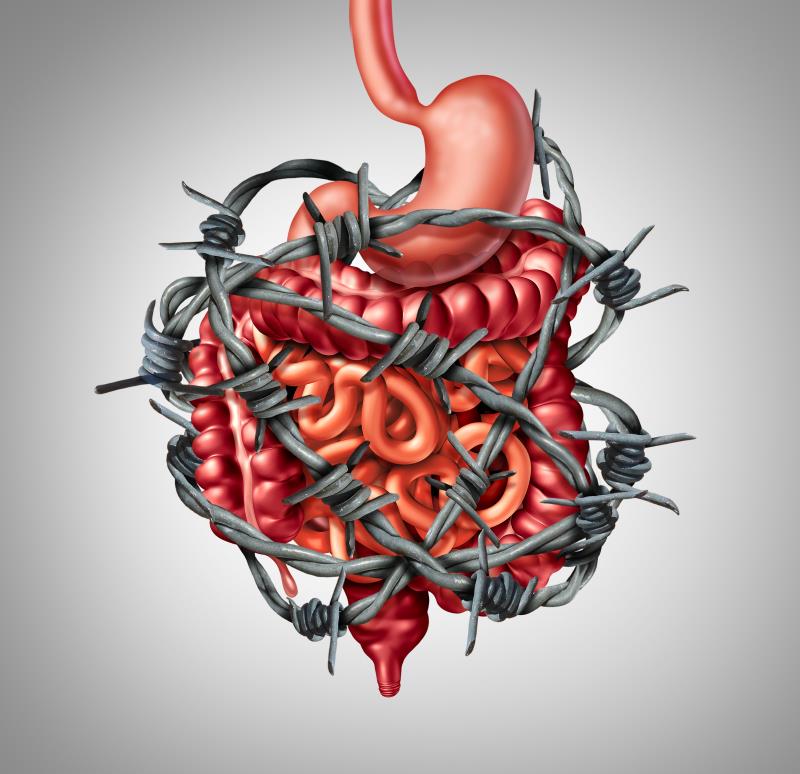 Neurophysiological factors linked to GI symptoms in IBS