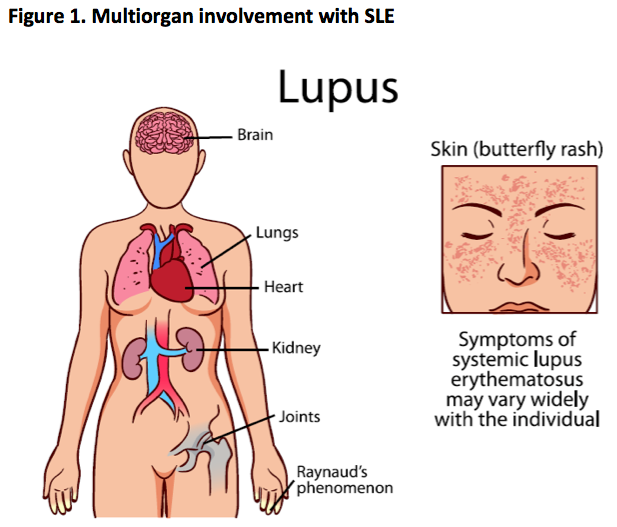 Limited health literacy tied to low knowledge on SLE