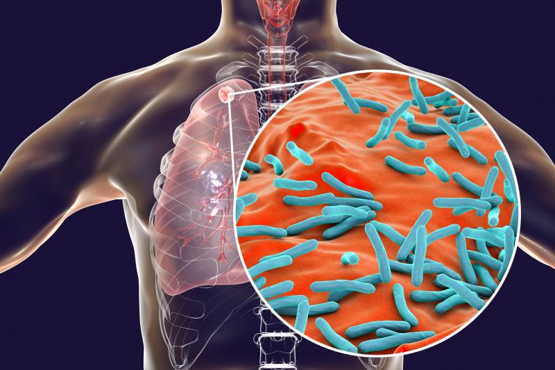 Revisiting tuberculosis