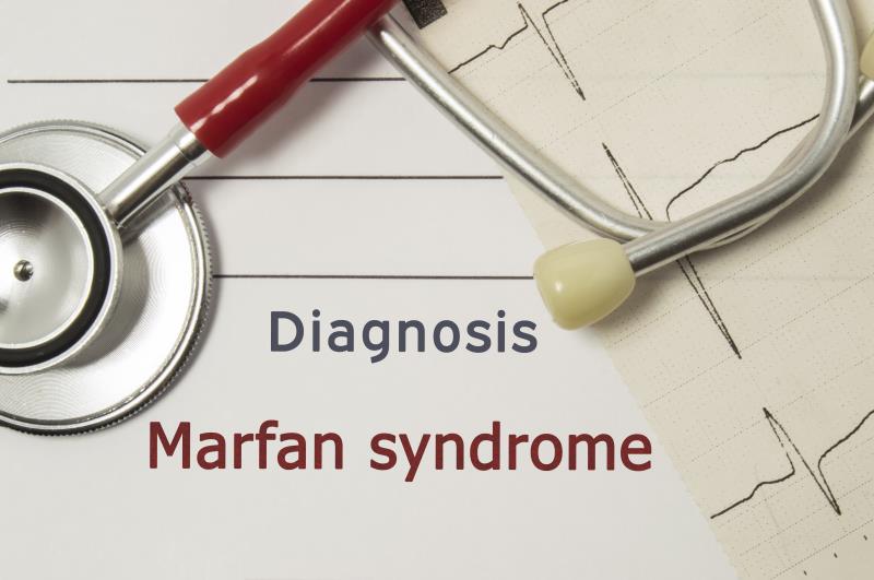 Irbesartan tied to lower aortic root dilatation rates in patients with Marfan syndrome