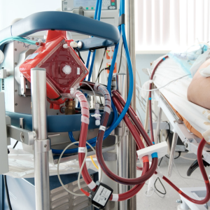 10-year HK study: How has ECMO utilization evolved in public hospitals?