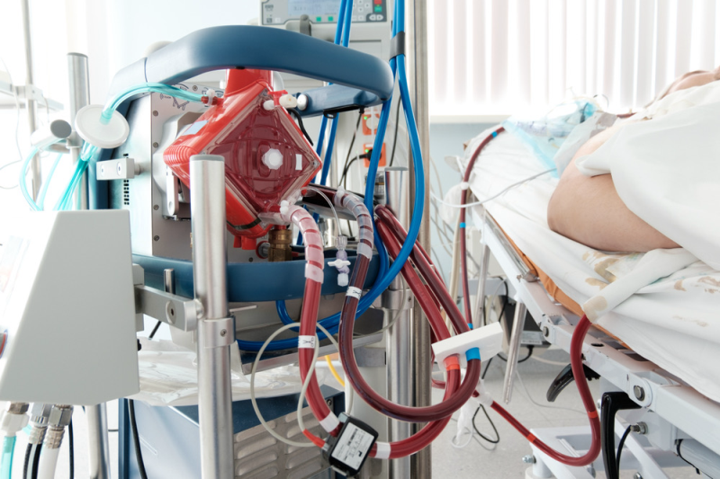 10-year HK study: How has ECMO utilization evolved in public hospitals?