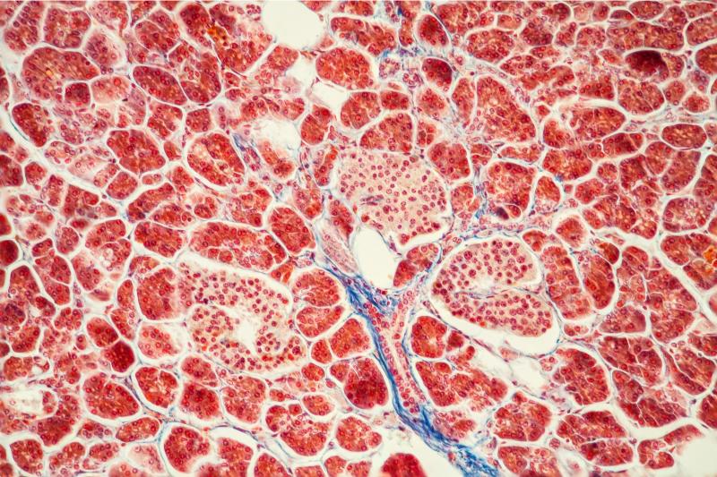 Pancreatic cells with islets under the microscope. (image credit: Shutterstock)