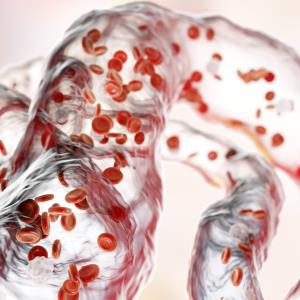 Metformin may have CV benefits in CKD patients with MetS