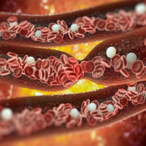 Coronary calcium scoring improves risk prediction in CAD patients