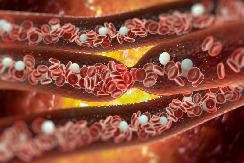 Coronary calcium scoring improves risk prediction in CAD patients