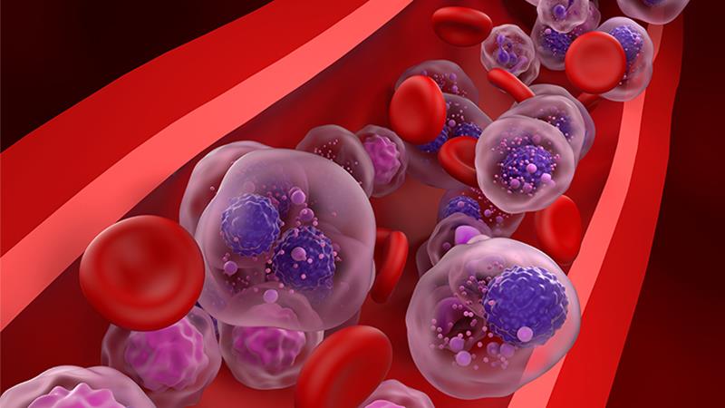 Myeloma patients may benefit from mezigdomide-dexamethasone doublet