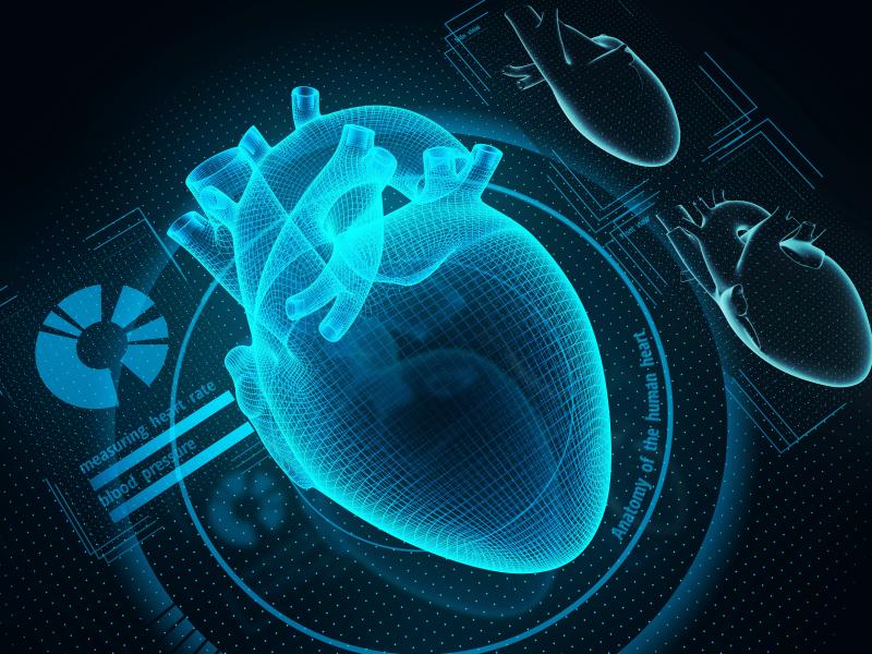 Insulin resistance by clamp analysis tied to LV dysfunction in diabetics