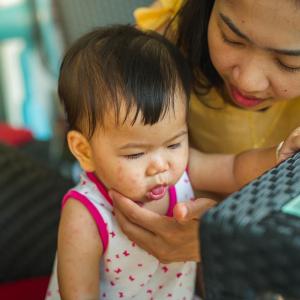 Admitted measles patients in Singapore present with vague symptoms