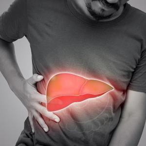 Multiple factors influence risks of cirrhosis, HCC in veterans with MAFLD