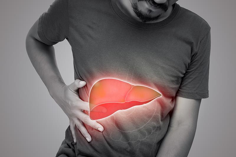 Multiple factors influence risks of cirrhosis, HCC in veterans with MAFLD