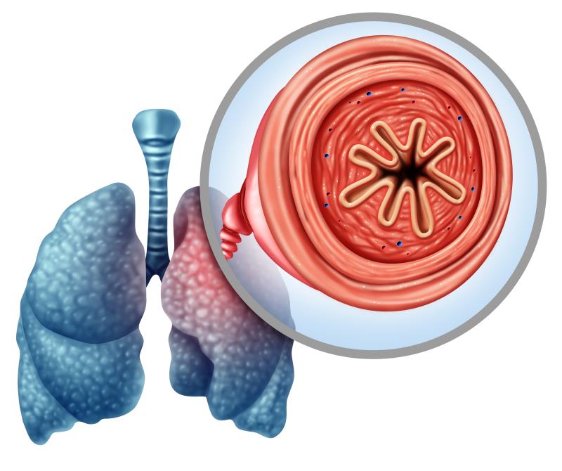 MV130 immunotherapy prevents COPD exacerbations