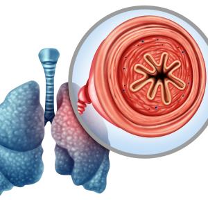 COPD associated with elevated risk of secondary spontaneous pneumothorax