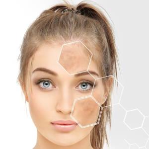 Revolutionary molecule improves
potency of skincare regimen for
hyperpigmentation disorders