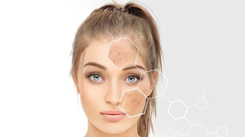 Revolutionary molecule improves
potency of skincare regimen for
hyperpigmentation disorders