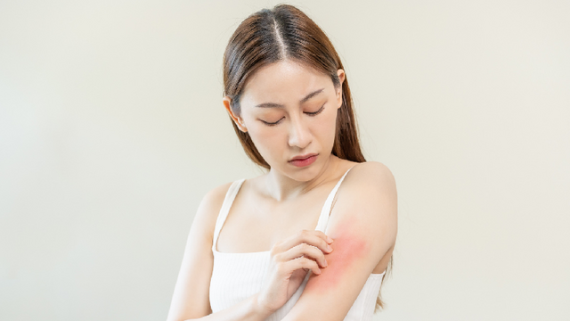 Ceramide and multivesicular emulsion technology:
The key to atopic dermatitis management