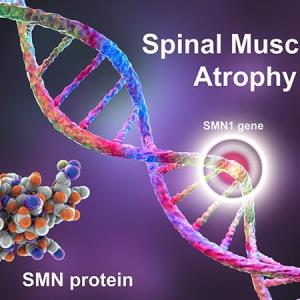 Management of paediatric patients with
spinal muscular atrophy by multidisciplinary
team of healthcare professionals