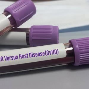 Management of
Steroid Refractory Graft
versus Host Disease