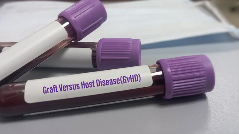 Management of
Steroid Refractory Graft
versus Host Disease