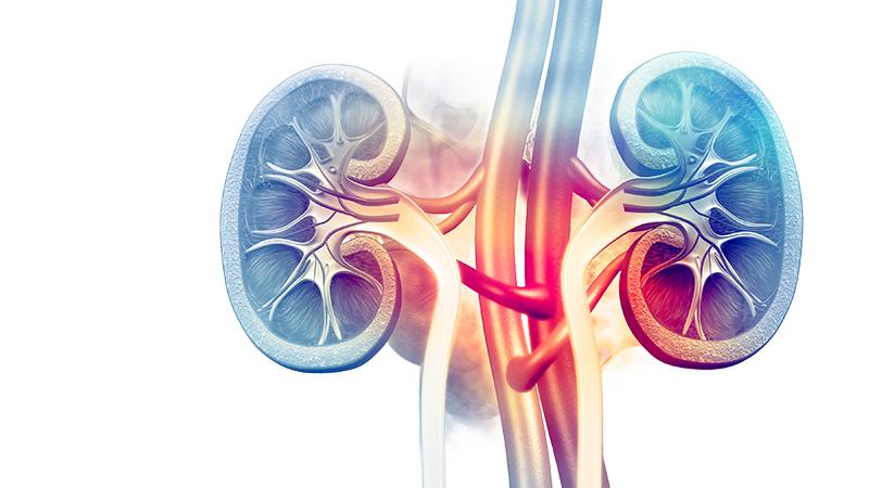 Silent but Serious: A Comprehensive Look at IgA Nephropathy and C3
Glomerulopathy in Glomerulonephritis