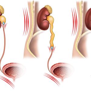 Most problems with flexible ureteroscopes attributed to surgeon error, inadequate maintenance