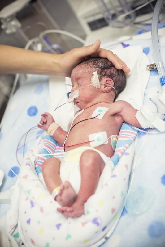 Sepsis a major cause of morbidity, death in VLBW infants