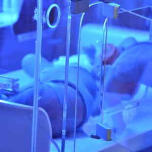 Several obstetric, neonatal characteristics linked to jaundice