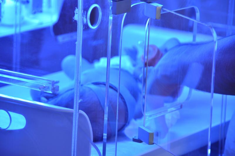 Several obstetric, neonatal characteristics linked to jaundice