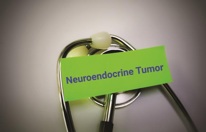 Expanding role of SSAs in neuroendocrine tumour management